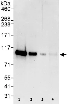 Western blot - Anti-FOXK1/MNF antibody (AB85999)