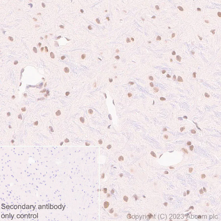 Immunohistochemistry (Formalin/PFA-fixed paraffin-embedded sections) - Anti-FOXK1/MNF antibody [EPR27320-65] (AB309510)