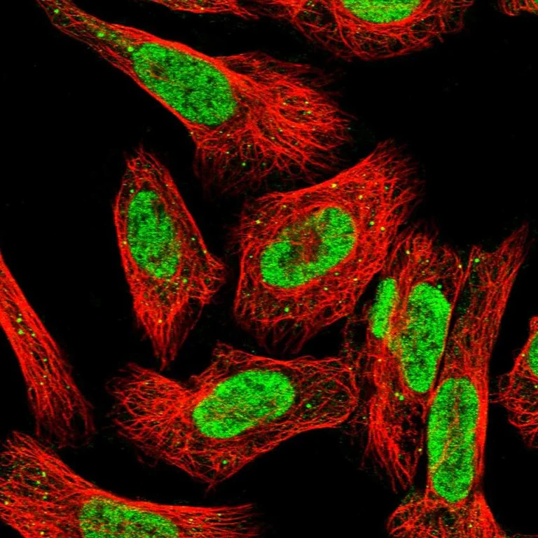 Immunocytochemistry/ Immunofluorescence - Anti-FOXK2 Antibody (AB327208)