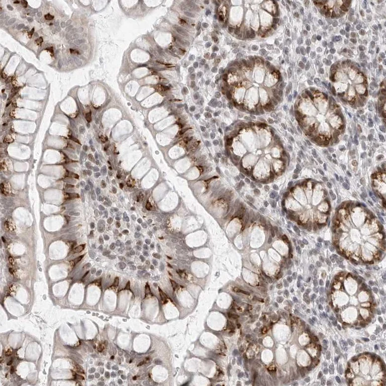 Immunohistochemistry (Formalin/PFA-fixed paraffin-embedded sections) - Anti-FOXK2 Antibody (AB327208)