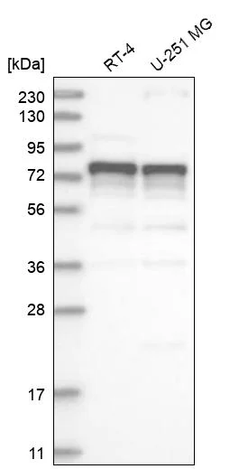 Western blot - Anti-FOXK2 Antibody (AB327208)