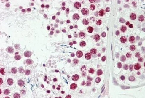 Immunohistochemistry (Formalin/PFA-fixed paraffin-embedded sections) - Anti-FOXL1 antibody (AB190226)