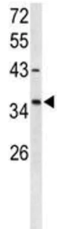 Western blot - Anti-FOXL1 antibody (AB190226)