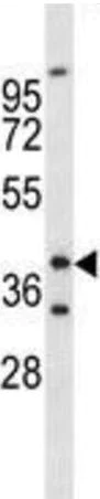 Western blot - Anti-FOXL1 antibody (AB190226)