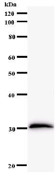 Western blot - Anti-FOXL2 antibody [262C1a] (AB58622), expandable thumbnail