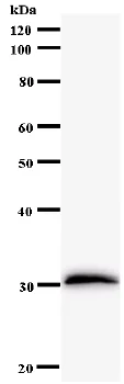 Western blot - Anti-FOXL2 antibody [262C1a] (AB58622)