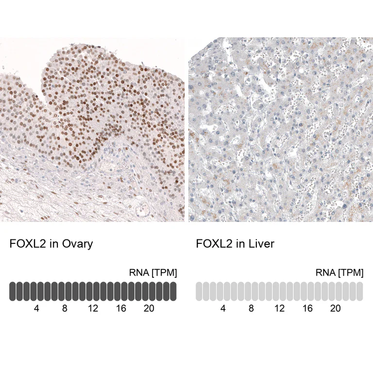 Immunohistochemistry (Formalin/PFA-fixed paraffin-embedded sections) - Anti-FOXL2 Antibody [CL12753] (AB327143)