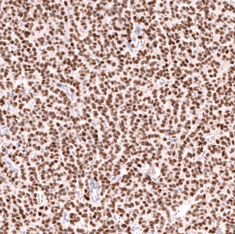 Immunohistochemistry (Formalin/PFA-fixed paraffin-embedded sections) - Anti-FOXL2 Antibody [CL12753] (AB327143)