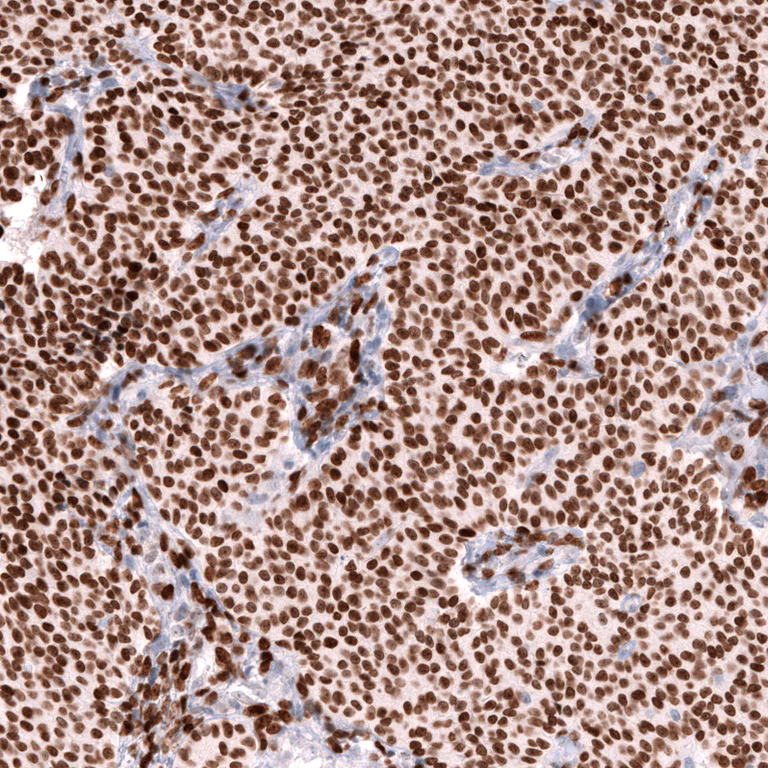 Immunohistochemistry (Formalin/PFA-fixed paraffin-embedded sections) - Anti-FOXL2 Antibody [CL12753] (AB327143)