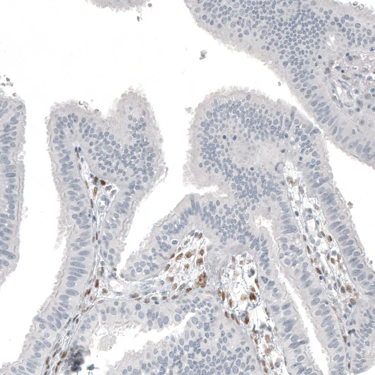 Immunohistochemistry (Formalin/PFA-fixed paraffin-embedded sections) - Anti-FOXL2 Antibody [CL12753] (AB327143)
