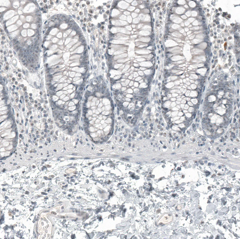 Immunohistochemistry (Formalin/PFA-fixed paraffin-embedded sections) - Anti-FOXL2 Antibody [CL12753] (AB327143)