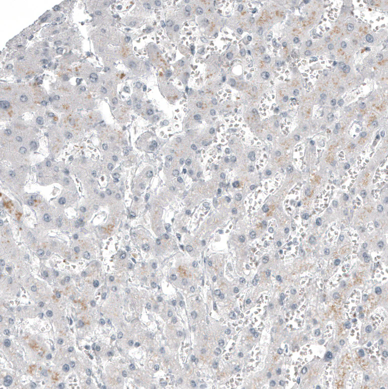Immunohistochemistry (Formalin/PFA-fixed paraffin-embedded sections) - Anti-FOXL2 Antibody [CL12753] (AB327143)