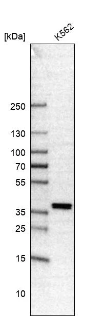 Western blot - Anti-FOXL2 Antibody [CL12753] (AB327143)