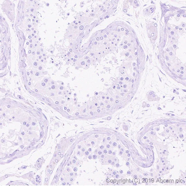Immunohistochemistry (Formalin/PFA-fixed paraffin-embedded sections) - Anti-FOXL2 antibody [EPR23523-68] (AB246511)