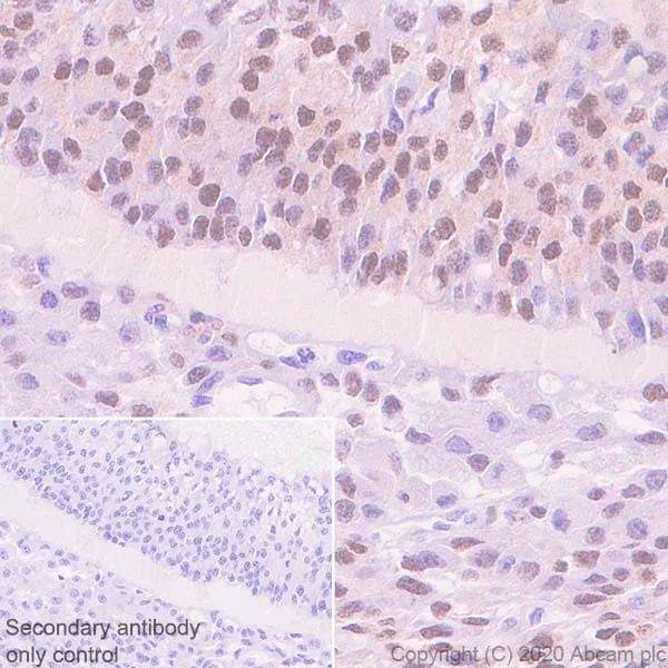 Immunohistochemistry (Formalin/PFA-fixed paraffin-embedded sections) - Anti-FOXL2 antibody [EPR23523-68] - BSA and Azide free (AB272050)