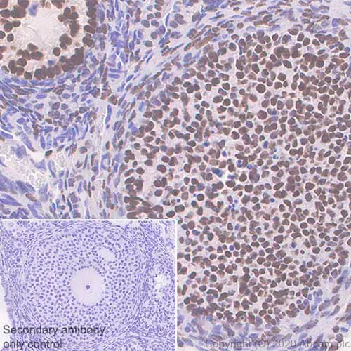 Immunohistochemistry (Formalin/PFA-fixed paraffin-embedded sections) - Anti-FOXL2 antibody [EPR23523-68] - BSA and Azide free (AB272050)