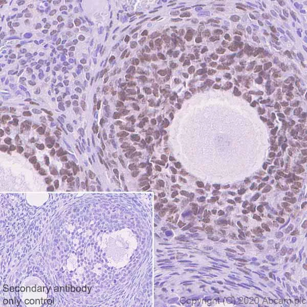 Immunohistochemistry (Formalin/PFA-fixed paraffin-embedded sections) - Anti-FOXL2 antibody [EPR23523-68] - BSA and Azide free (AB272050)