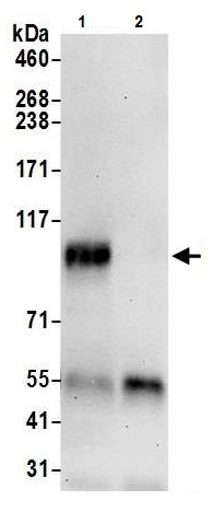 Immunoprecipitation - Anti-FOXM1 antibody (AB245309)