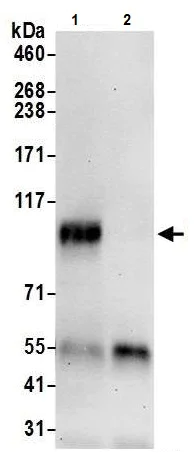 Immunoprecipitation - Anti-FOXM1 antibody (AB245309)