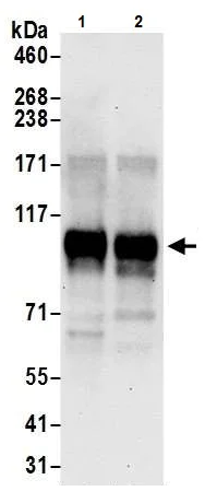 Western blot - Anti-FOXM1 antibody (AB245309)