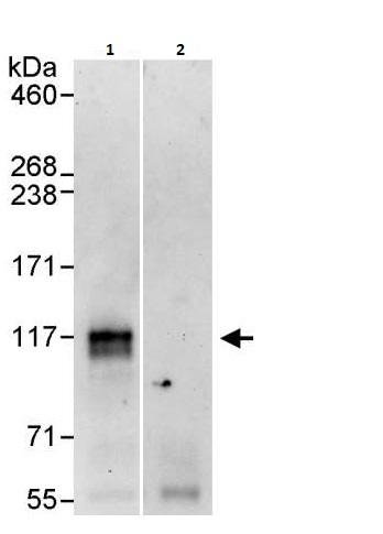 Immunoprecipitation - Anti-FOXM1 antibody (AB264210)