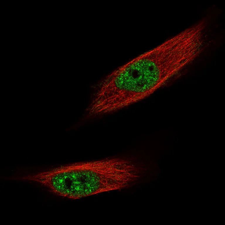 Immunocytochemistry/ Immunofluorescence - Anti-FOXM1 Antibody [CL12131] (AB327138)