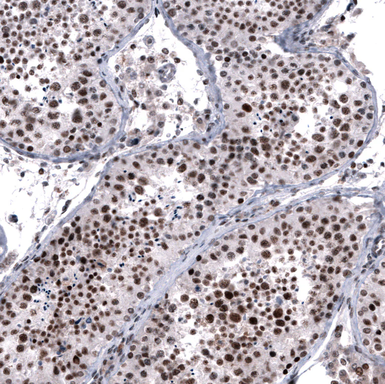 Immunohistochemistry (Formalin/PFA-fixed paraffin-embedded sections) - Anti-FOXM1 Antibody [CL12131] (AB327138)