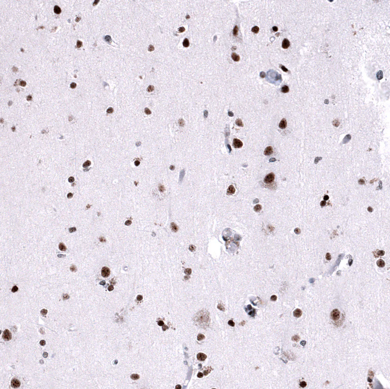 Immunohistochemistry (Formalin/PFA-fixed paraffin-embedded sections) - Anti-FOXM1 Antibody [CL12131] (AB327138)