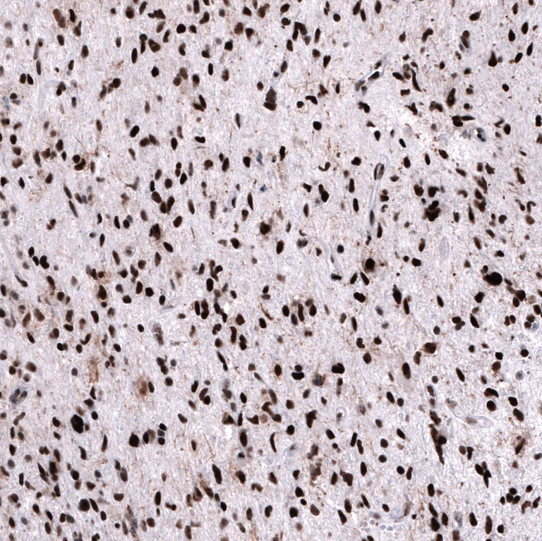 Immunohistochemistry (Formalin/PFA-fixed paraffin-embedded sections) - Anti-FOXM1 Antibody [CL12131] (AB327138)