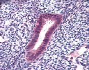 Immunohistochemistry (Formalin/PFA-fixed paraffin-embedded sections) - Anti-FOXN1 antibody (AB113235)