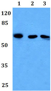 Western blot - Anti-FOXN1 antibody (AB192319)