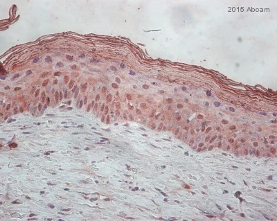Immunohistochemistry (Formalin/PFA-fixed paraffin-embedded sections) - Anti-FOXN1 antibody (AB26069)