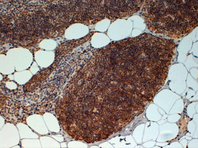 Immunohistochemistry (Formalin/PFA-fixed paraffin-embedded sections) - Anti-FOXN1 antibody (AB26069)