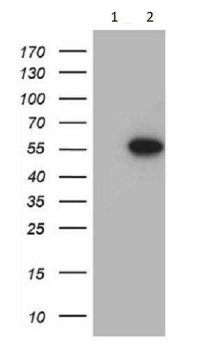 Western blot - Anti-FOXN2 antibody [OTI5H8] (AB236385)
