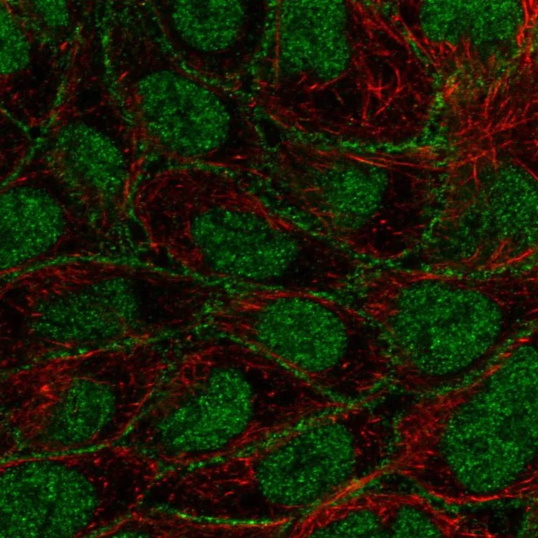 Immunocytochemistry/ Immunofluorescence - Anti-FOXN3 antibody (AB251954)