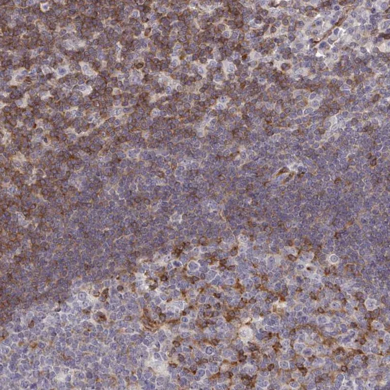 Immunohistochemistry (Formalin/PFA-fixed paraffin-embedded sections) - Anti-FOXN3 antibody (AB251954)