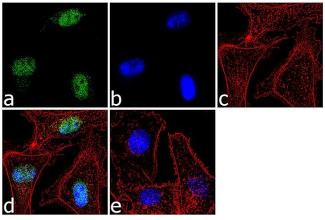 Immunocytochemistry/ Immunofluorescence - Anti-FOXN3 Antibody [RP23040211] (AB313485), expandable thumbnail