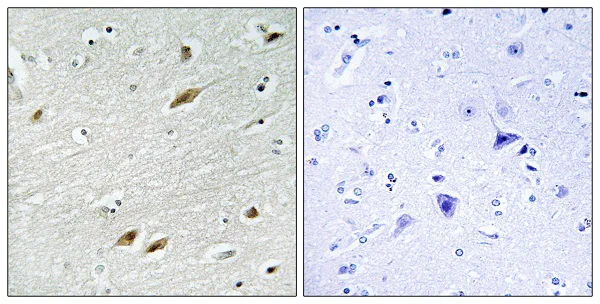 Immunohistochemistry (Formalin/PFA-fixed paraffin-embedded sections) - Anti-FOXO1A antibody (AB39670)
