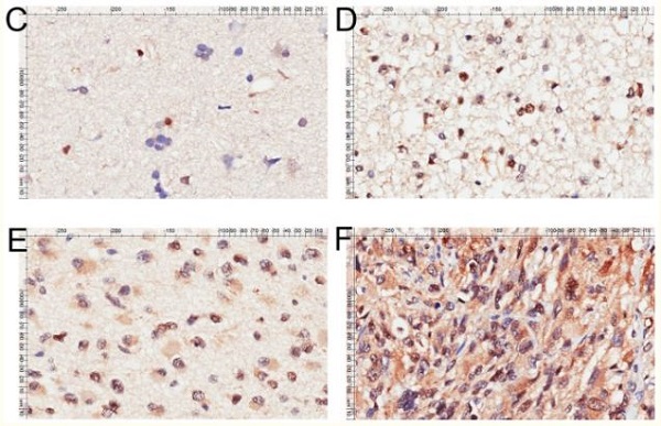 Immunohistochemistry (Formalin/PFA-fixed paraffin-embedded sections) - Anti-FOXO1A antibody (AB39670)