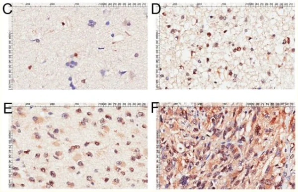 Immunohistochemistry (Formalin/PFA-fixed paraffin-embedded sections) - Anti-FOXO1A antibody (AB39670)