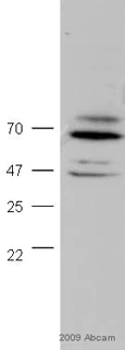 Western blot - Anti-FOXO1A antibody (AB39670)
