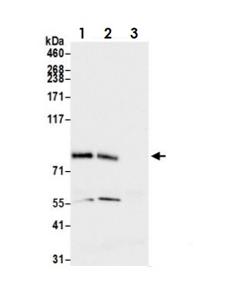Immunoprecipitation - Anti-FOXO1A antibody (AB70382)