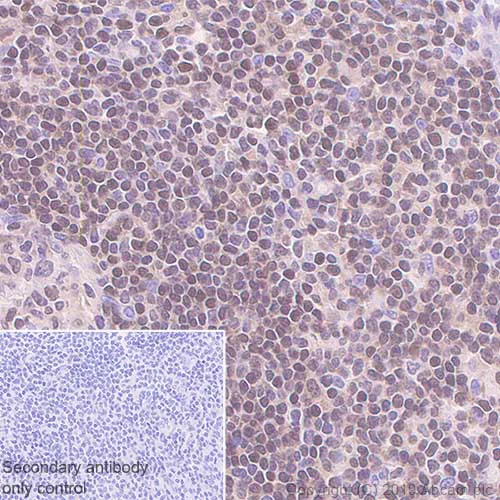Immunohistochemistry (Formalin/PFA-fixed paraffin-embedded sections) - Anti-FOXO1A antibody [EPR12020] (AB179450)