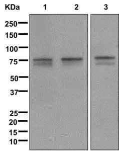 Western blot - Anti-FOXO1A antibody [EPR12020] (AB179450)