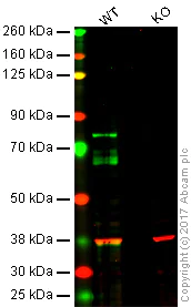Western blot - Anti-FOXO1A antibody [EPR12020] (AB179450)