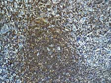 Immunohistochemistry (Formalin/PFA-fixed paraffin-embedded sections) - Anti-FOXO1A antibody [EPR12020] - BSA and Azide free (ab240212), expandable thumbnail