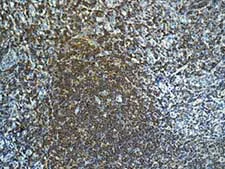 Immunohistochemistry (Formalin/PFA-fixed paraffin-embedded sections) - Anti-FOXO1A antibody [EPR12020] - BSA and Azide free (AB240212)