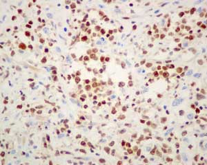Immunohistochemistry (Formalin/PFA-fixed paraffin-embedded sections) - Anti-FOXO1A antibody [EPR12020] - BSA and Azide free (AB240212), expandable thumbnail