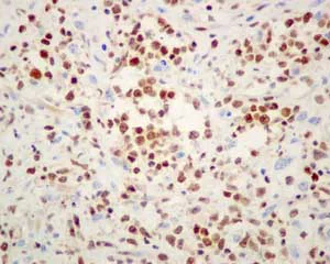 Immunohistochemistry (Formalin/PFA-fixed paraffin-embedded sections) - Anti-FOXO1A antibody [EPR12020] - BSA and Azide free (AB240212)