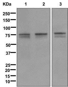 Western blot - Anti-FOXO1A antibody [EPR12020] - BSA and Azide free (AB240212), expandable thumbnail